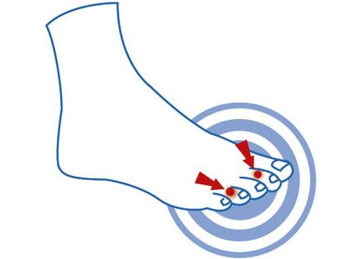 epitact teendrukbeschermingspad 