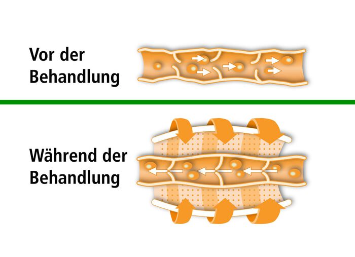 Beurer adermassager FM 150 BLAUW
