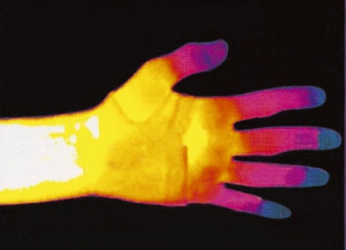 Bandages in verschillende uitvoeringen CRÈME