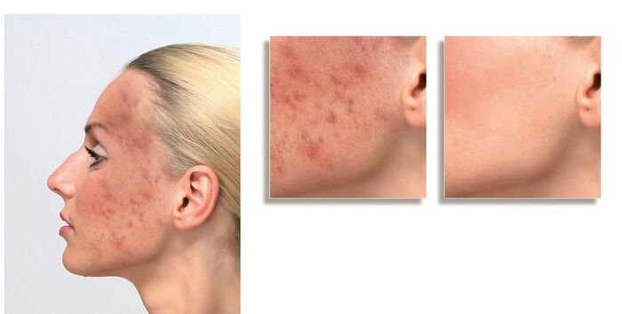 ELITE Dekmake-up DONKER